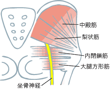 坐骨神経痛の原因　梨状筋症候群